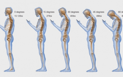 What Is Your Head Position Doing To Your Spine?