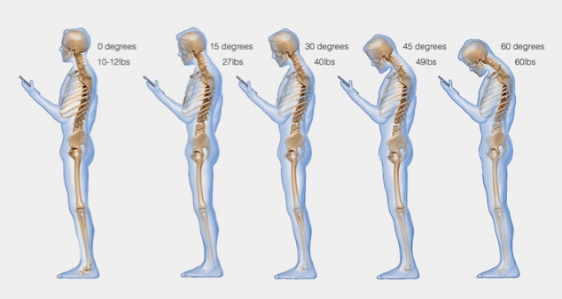 What Is Your Head Position Doing To Your Spine?